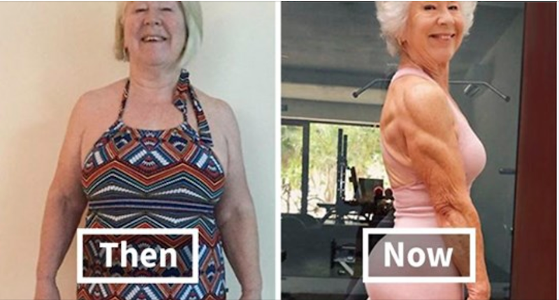 Daughter Helps 73 Year Old Mom Lose 50 Pounds To Get Her Health Back On Track And Her Before 